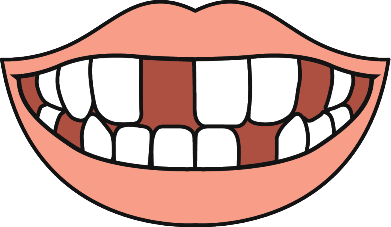 missing teeth2x min