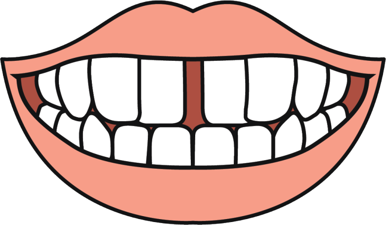 tooth gaps2x min